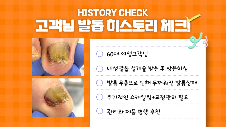 내성발톱 수술받은 여성고객